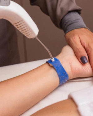 Laserterapia ILIB
